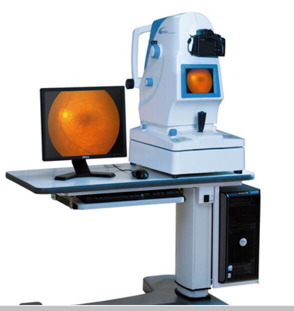 六六YZ50A免散瞳眼底照相機